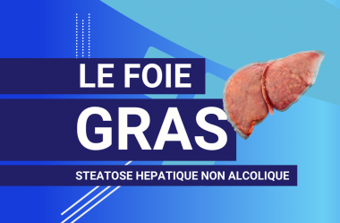 Comment diminuer la graisse dans le foie – Foie Gras – Stéatose Hépatique non alcoolique