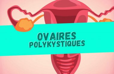 Syndrome des ovaires Polykystiques – Comment le contrôler avec l’alimentation